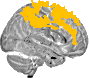 Sagittal slice