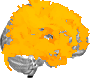 Sagittal slice