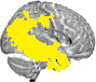 Sagittal slice