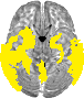 Transverse slice