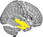 Sagittal slice