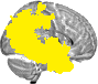 Sagittal slice