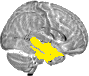 Sagittal slice