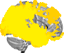 Sagittal slice