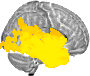 Sagittal slice