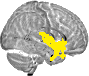 Sagittal slice