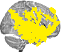 Sagittal slice