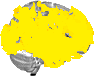 Sagittal slice